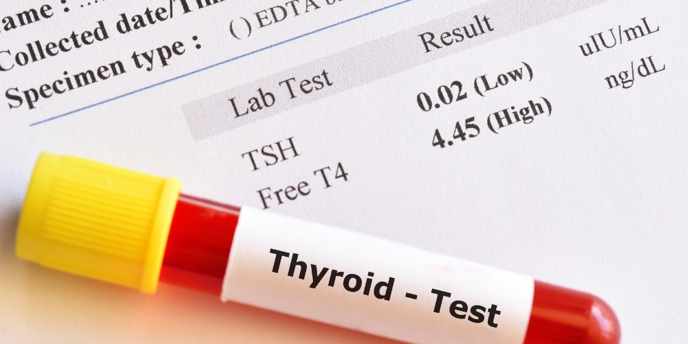 What No One Tells You About Thyroid Labs
